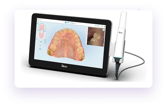iTero Element 3D scanner tablet showing a 3D dental scan